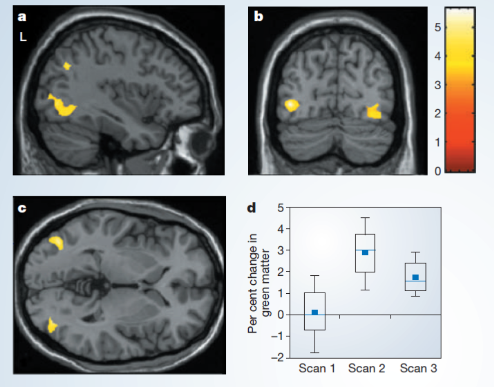 case study 2 draganski et al. (2006)