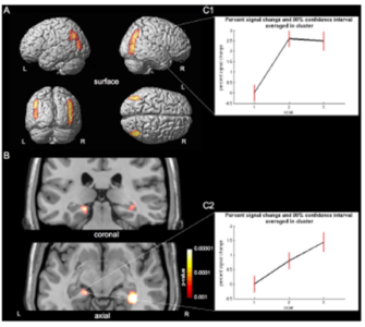 case study 2 draganski et al. (2006)